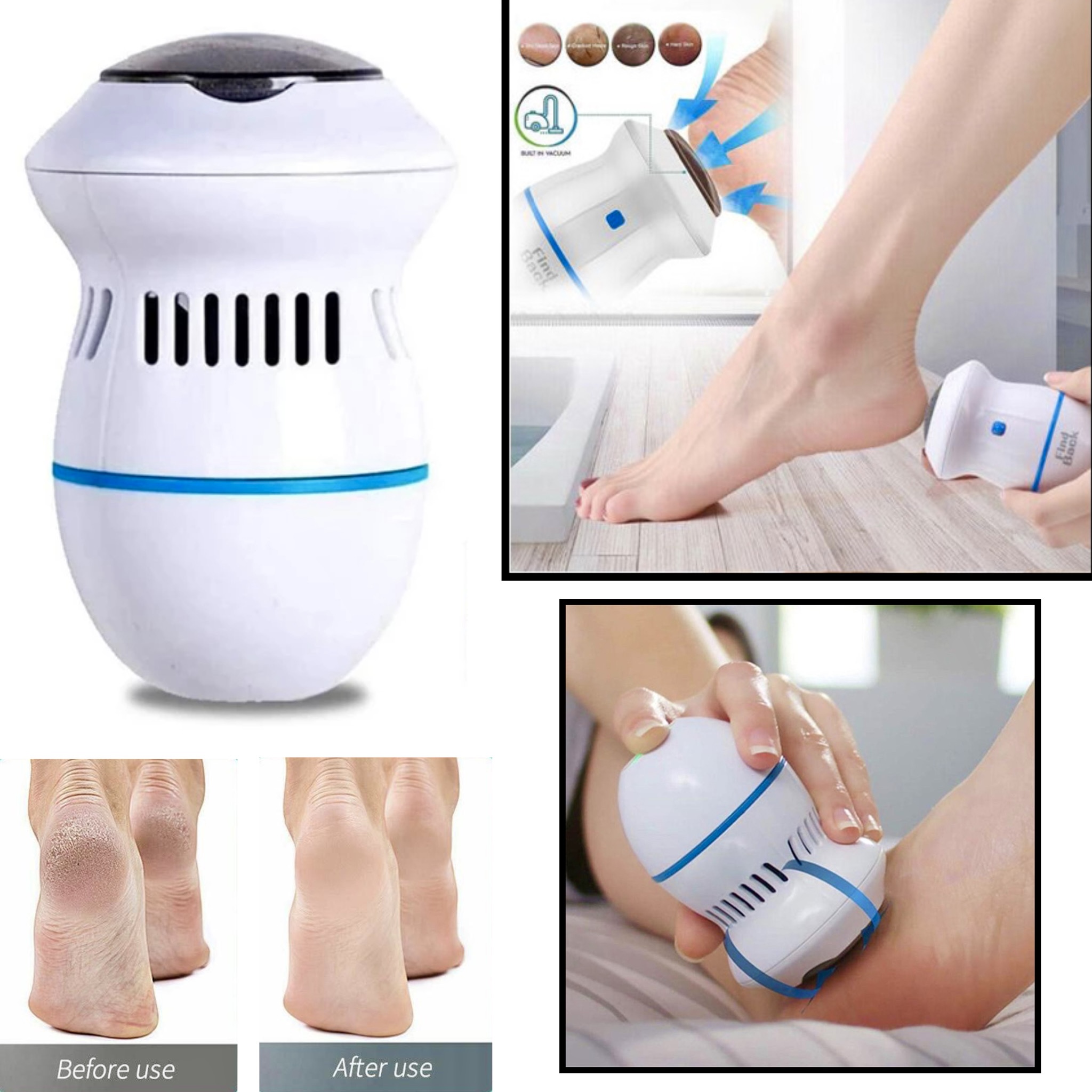 Electric Automatic Foot Pedicure Grinder Remover Dead Skin Remover